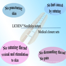 Fermeture médicale des blessures consommable avec ISO13485